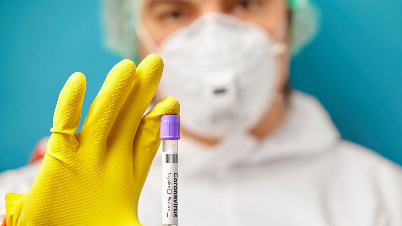 A Universidade realizará probas PCR mediante saliva a todo o seu persoal