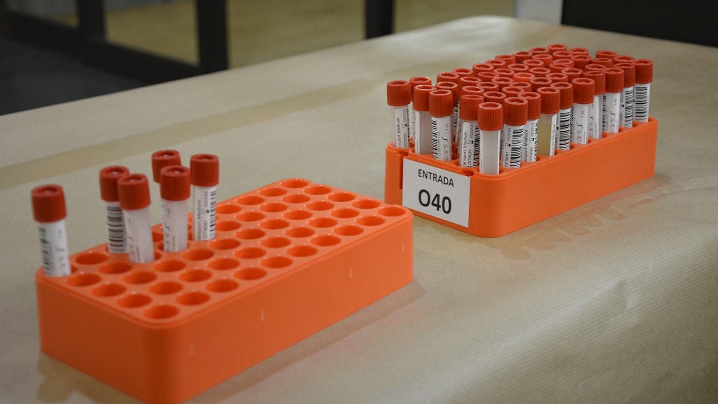 O PDI e o PAS da UVigo poderá realizar test  PCR sobre saliva os días 10 e 11 e xaneiro de 2022
