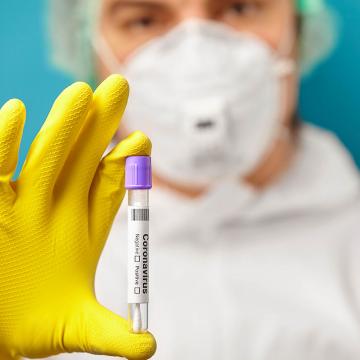 A Universidade realizará probas PCR mediante saliva a todo o seu persoal
